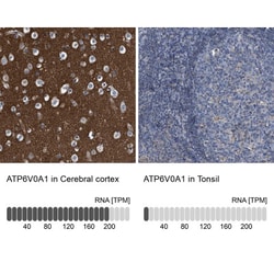 ATP6V0A1 Antibody, Novus Biologicals 0.1mL; Unlabeled:Antibodies, Polyclonal